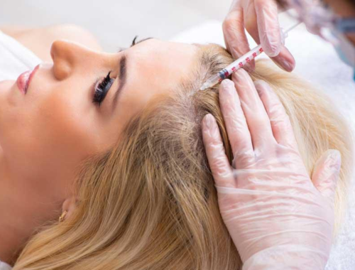 6 Signs You Should Try PRP Injections